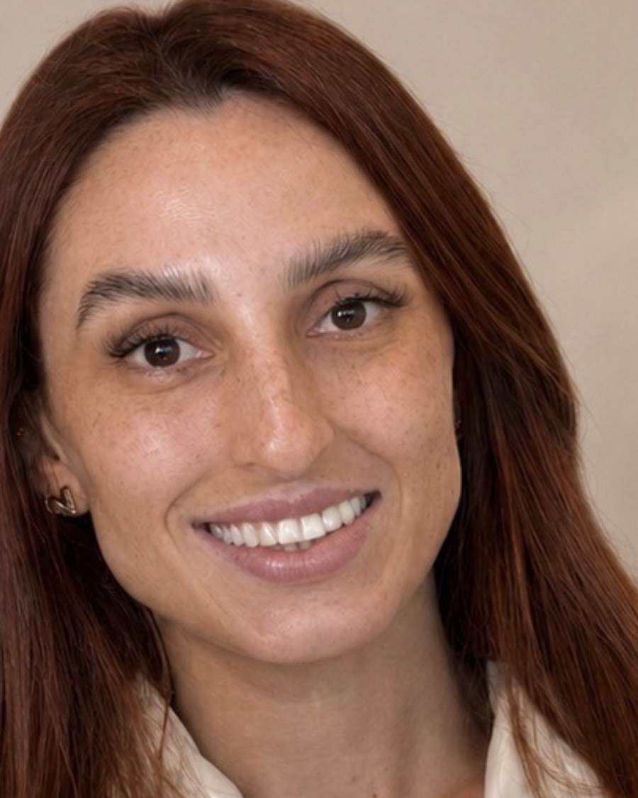 Antes: paciente com dois implantes na frente e sorriso desarmônico
