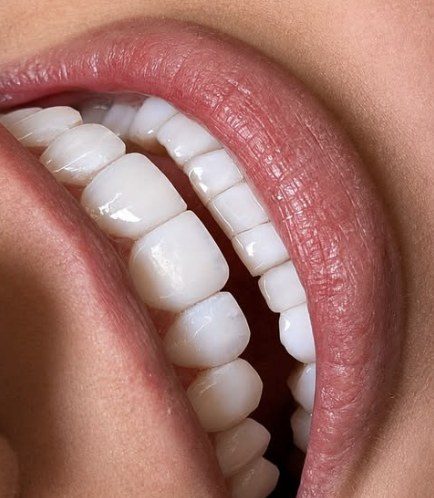 Detalhe de lentes com efeito porcelana